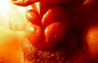 XXX बहुत गंभीर स्त्री रोग विशेषज्ञ के साथ सेक्स